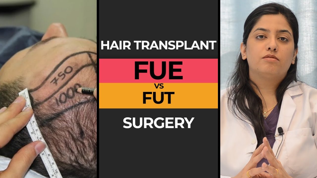 Best Hair Transplant Clinic in Karachi